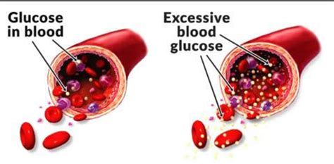 blood sugar and ed